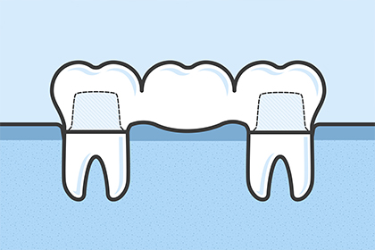 ビジュアルマックスを使って分かりやすくご説明します