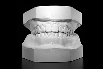 3：噛み合わせの記録